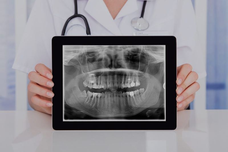 Dentist reviewing a panoramic dental X-ray on a tablet during a check-up