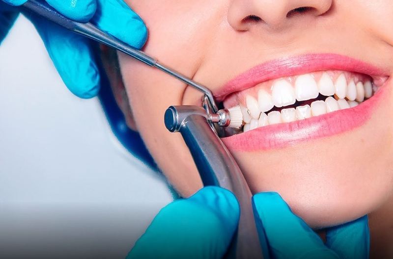 Dental hygienist polishing a patient's teeth during a routine cleaning